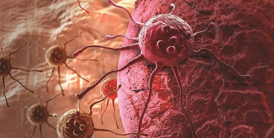 🌍 Global Cancer Cases Set to Hit 30 Million a Year by 2050, Poor Countries Hardest Hit