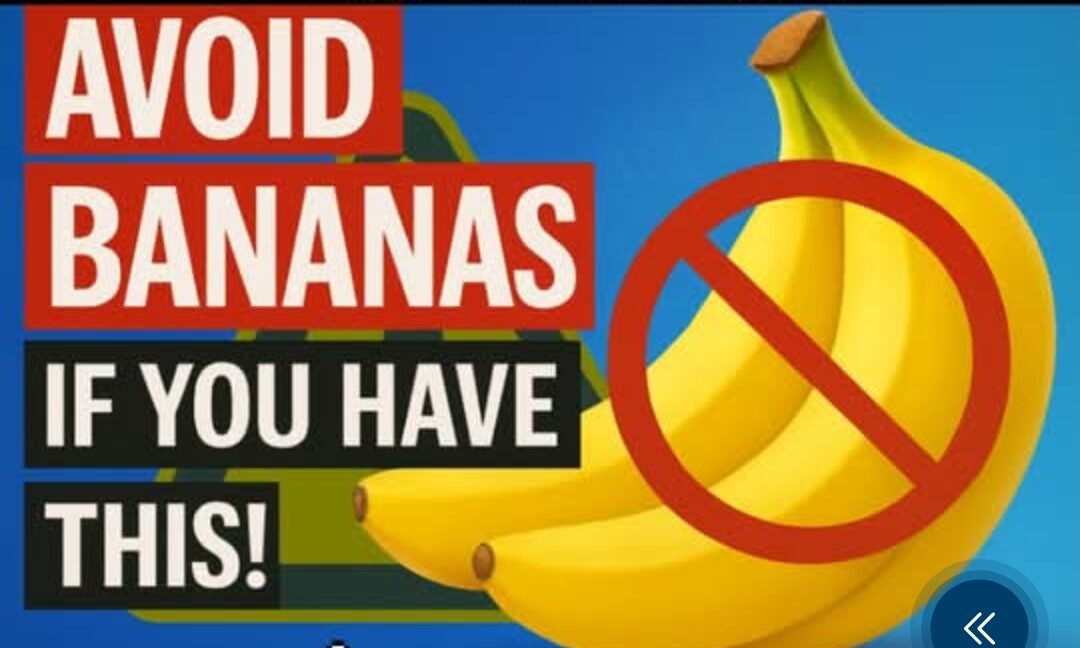 The Yellow Line: Why Some People Should Limit or Avoid Bananas